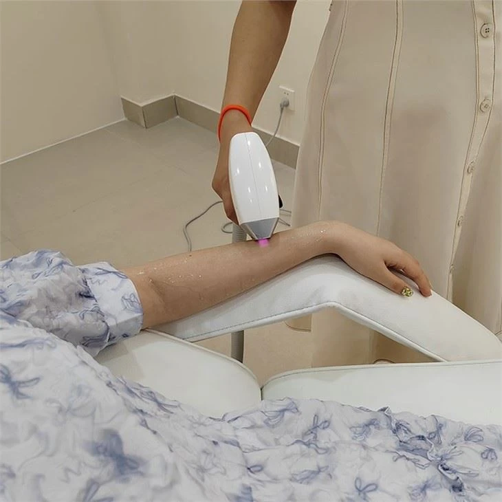 Portable Laser Hair Removal Machine