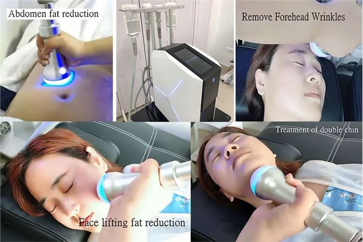 Powerful Of Cryotherapy