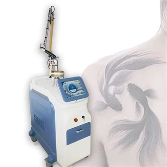 Laser de picossegundo para remoção de super tatuagem