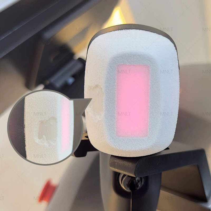Diode Laser Hair Removal Machine Supplier