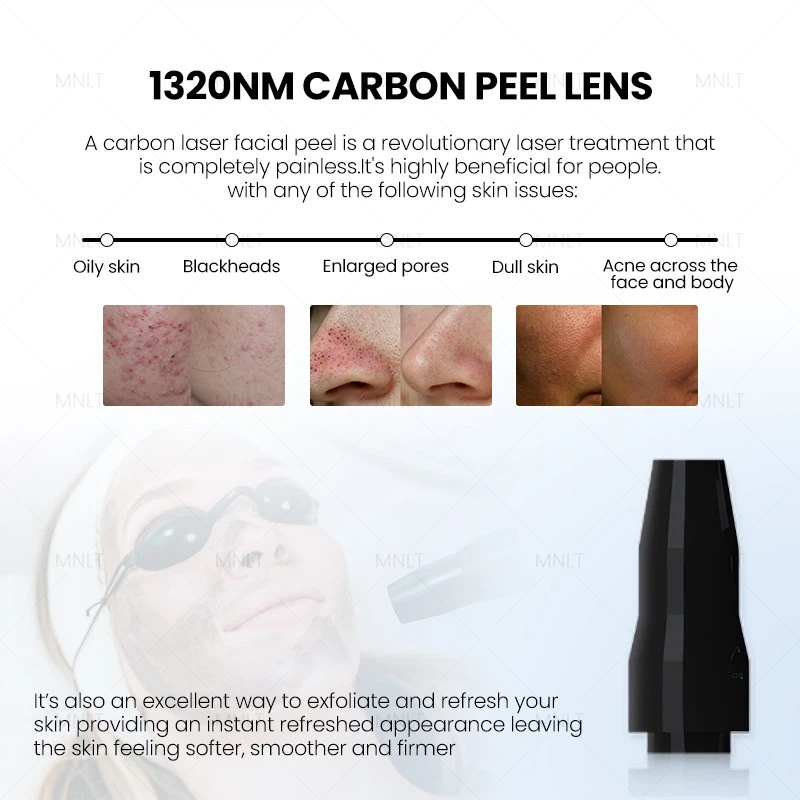 ND YAG Laser Machine – Professional Solution For Tattoo Removal & Skin Treatments price