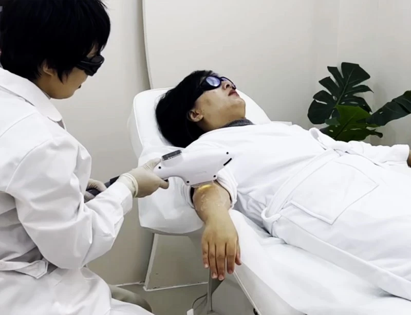 IPL Laser Hair Removal IPL Laser Hair Removal