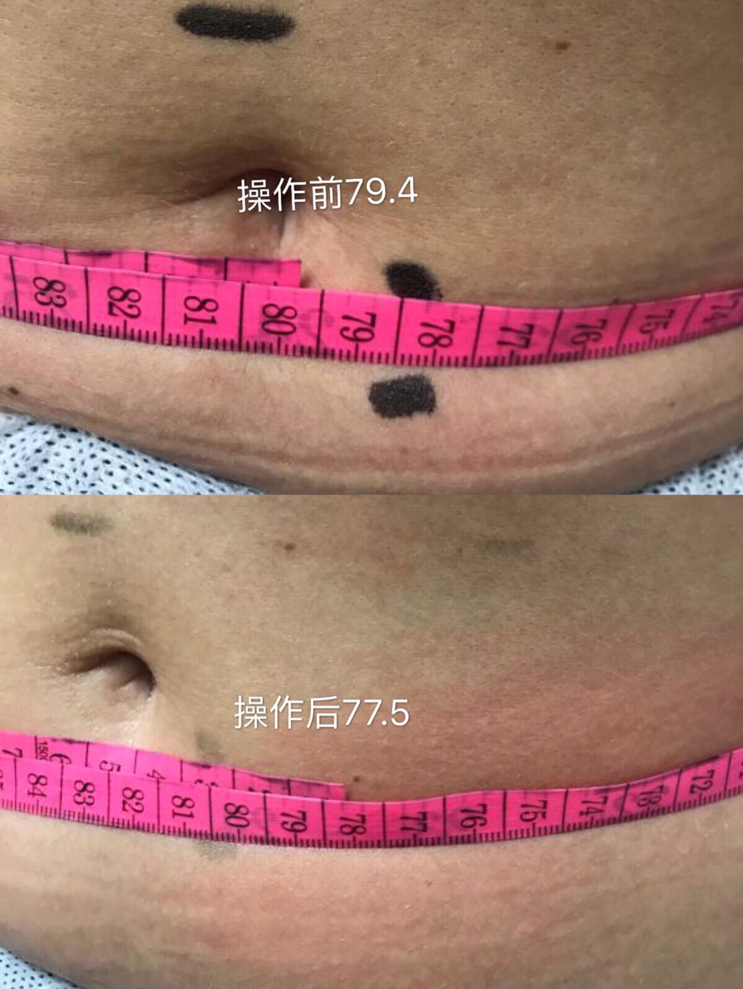 before and after 1