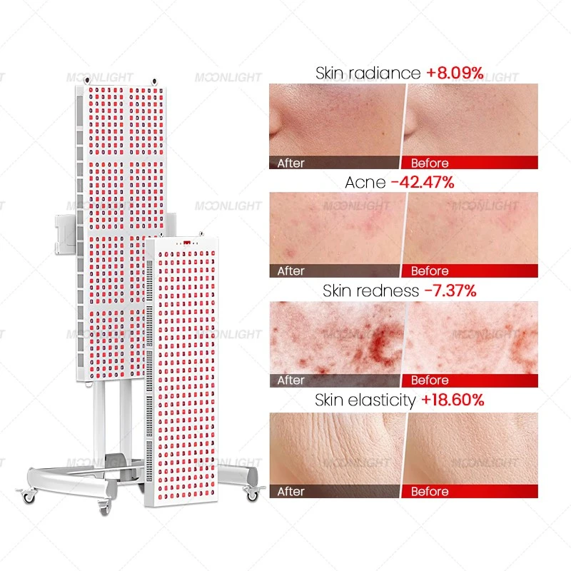 Red Light Therapy Pain Relief