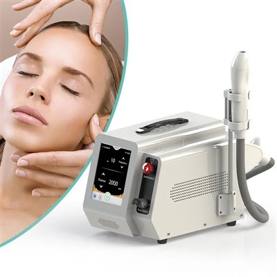 ND YAG Máquina de remoção de tatuagem a laser