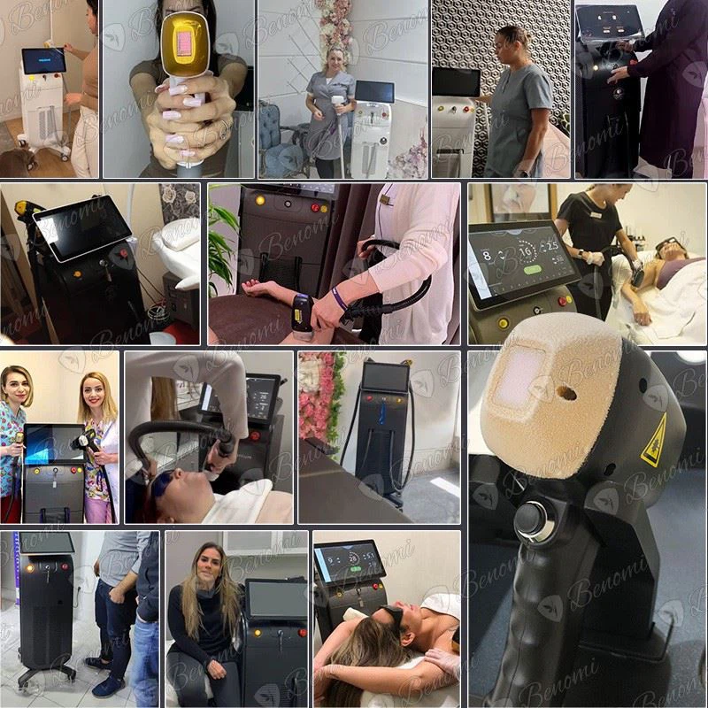 Soprano Titanium FDA-Certified Laser Hair Removal Machine factory