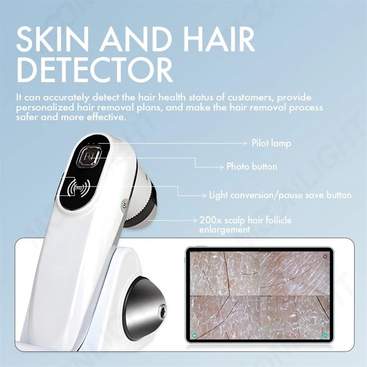 The First Laser Hair Removal Machine With AI Application
